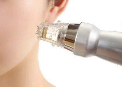 Мікроголковий RF ліфтінг